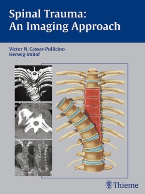 cover image of Spinal Trauma--An Imaging Approach